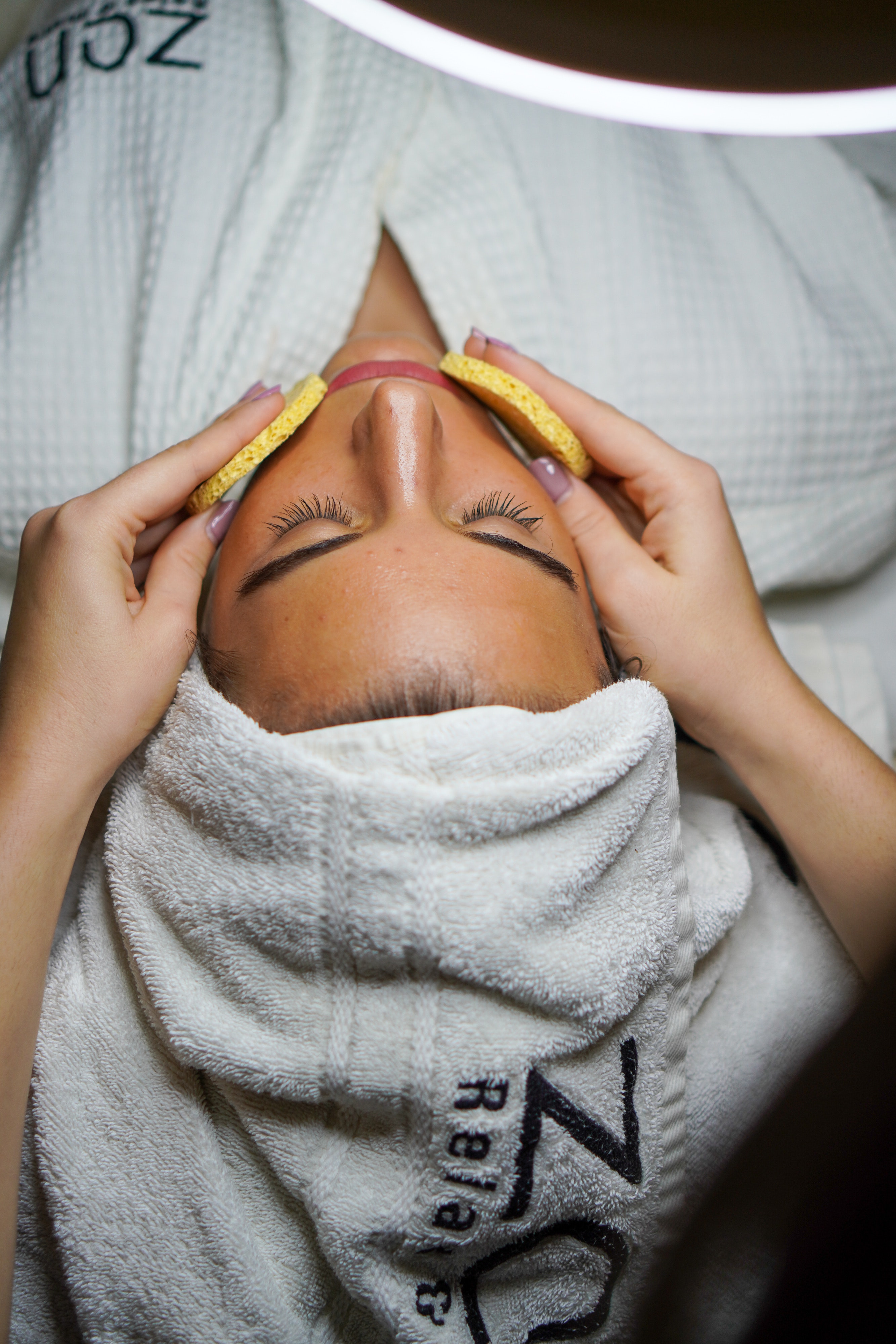 laser skin treatment in Sydney