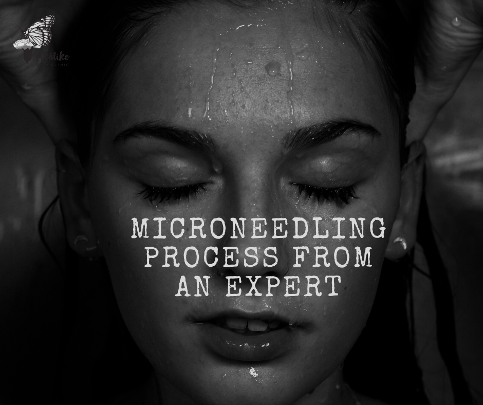 microneedling sydney