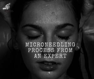 microneedling sydney
