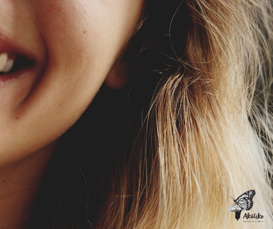 laser skin treatment in Sydney