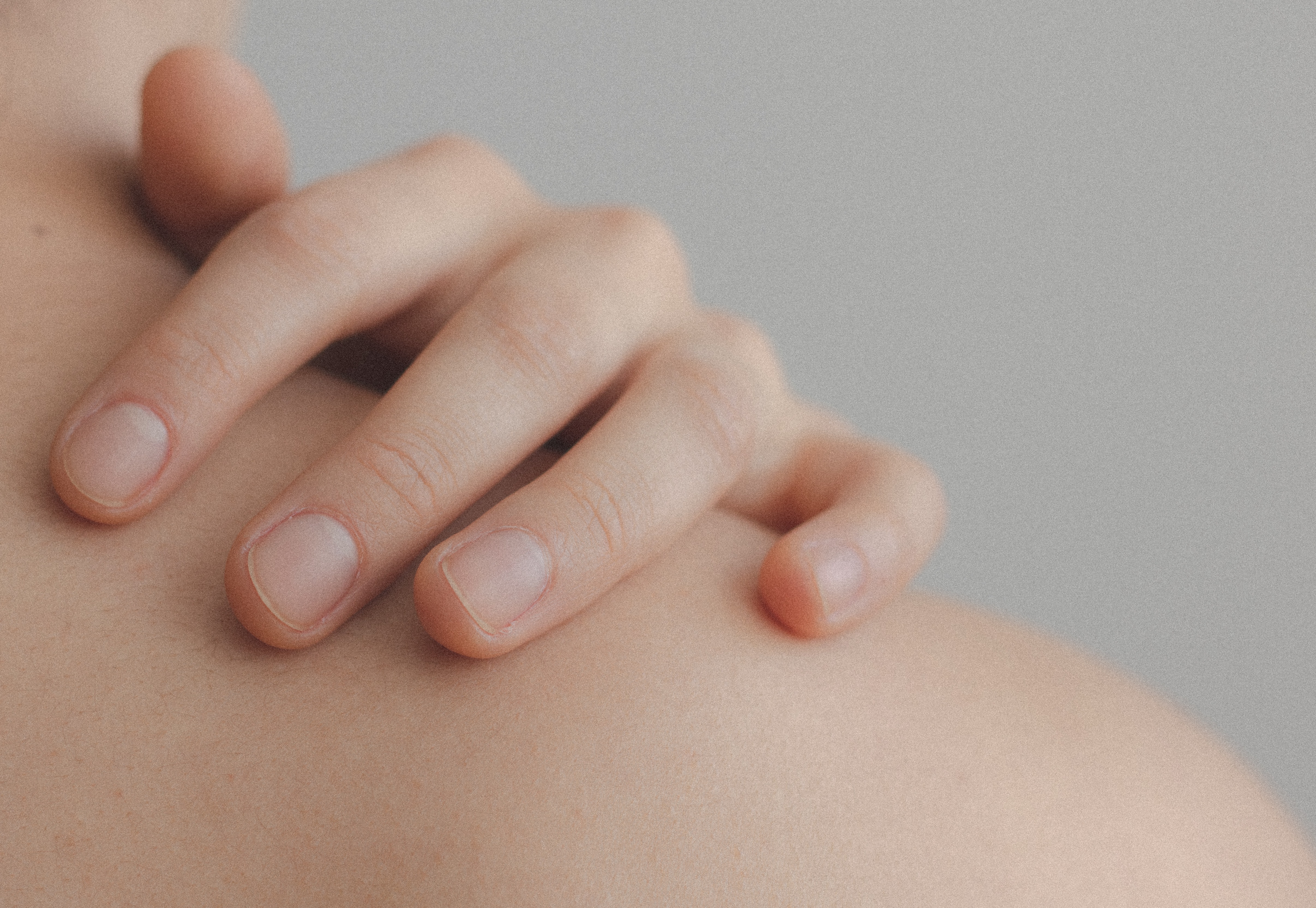 laser skin treatment Sydney
